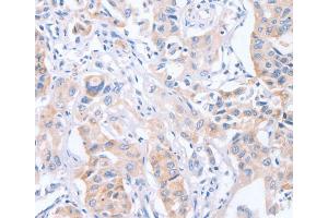 Immunohistochemistry (IHC) image for anti-Cell Division Cycle Associated 4 (CDCA4) antibody (ABIN2434444) (CDCA4 anticorps)