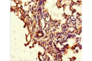 Immunohistochemistry of paraffin-embedded human lung tissue using ABIN7144942 at dilution of 1:100 (ABCG8 anticorps  (AA 176-413))
