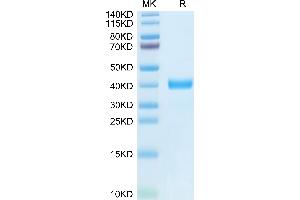 Human MFAP4 on Tris-Bis PAGE under reduced condition.