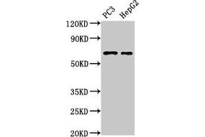 Western Blot Positive WB detected in: PC-3 whole cell lysate, HepG2 whole cell lysate All lanes: PARP2 antibody at 3 μg/mL Secondary Goat polyclonal to rabbit IgG at 1/50000 dilution Predicted band size: 67, 65 kDa Observed band size: 67 kDa (PARP2 anticorps  (AA 14-149))