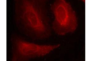 Immunofluorescence staining of methanol-fixed Hela cells using PDK1(Phospho-Ser241) Antibody. (PDPK1 anticorps  (pSer241))