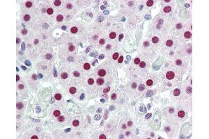 Anti-DDB1 antibody IHC of human adrenal. (DDB1 anticorps)