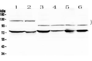 Western blot analysis of NFATC4 using anti-NFATC4 antibody . (NFATC4 anticorps  (AA 413-522))
