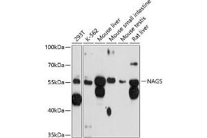 Western blot analysis of extracts of various cell lines, using NAGS antibody (ABIN6130570, ABIN6144346, ABIN6144347 and ABIN6215659) at 1:3000 dilution. (NAGS anticorps  (AA 295-534))