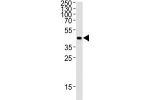 Western blot analysis of lysate from 12 tag recombinant protein (41 kDa) using GST Tag antibody at 1:1000. (GST-Tag anticorps)