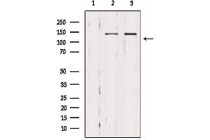 Western blot analysis of extracts from various samples, using MAST3 Antibody. (MAST3 anticorps  (Internal Region))