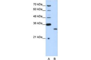 Western Blotting (WB) image for anti-CPX Chromosome Region, Candidate 1 (CPXCR1) antibody (ABIN2461963) (CPXCR1 anticorps)