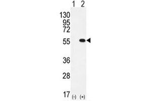 Western blot analysis of PRMT2 antibody and 293 cell lysate either nontransfected (Lane 1) or transiently transfected (2) with the PRMT2 gene.