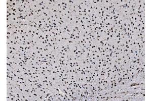 IHC analysis of DBC-1/CCAR2 using anti-DBC-1/CCAR2 antibody (ABIN7602235). (CCAR2 anticorps  (AA 65-917))