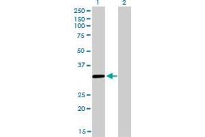 Western Blot analysis of ZNF346 expression in transfected 293T cell line by ZNF346 monoclonal antibody (M01), clone 2D10. (ZNF346 anticorps  (AA 133-232))