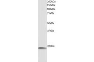 Image no. 1 for anti-Heat Shock 22kDa Protein 8 (HSPB8) (AA 184-196) antibody (ABIN292049) (HSPB8 anticorps  (AA 184-196))