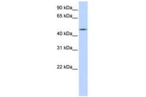Image no. 1 for anti-Chromosome 20 Open Reading Frame 160 (C20orf160) (AA 71-120) antibody (ABIN6741141) (C20orf160 anticorps  (AA 71-120))