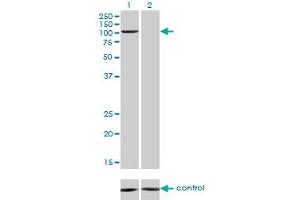 Western blot analysis of PCAF over-expressed 293 cell line, cotransfected with PCAF Validated Chimera RNAi (Lane 2) or non-transfected control (Lane 1). (KAT2B anticorps  (AA 353-452))