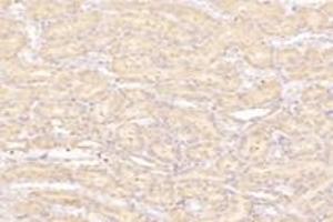 Immunohistochemistry analysis of paraffin-embedded rat kidney using,PTGFR (ABIN7075209) at dilution of 1: 800