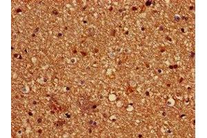 Immunohistochemistry of paraffin-embedded human brain tissue using ABIN7162619 at dilution of 1:100 (Paralemmin anticorps  (AA 1-384))