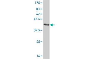 Western Blot detection against Immunogen (40. (BRD3 anticorps  (AA 418-556))