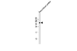 Anti-FAT4 Antibody at 1:2000 dilution + Recombinant protein at 20 ng per lane. (FAT4 anticorps  (AA 4500-4786))