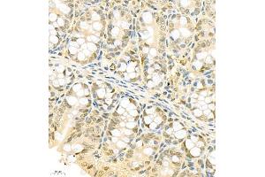 Immunohistochemistry of paraffin embedded mouse colon using Thymosin (ABIN7075306) at dilution of 1:750 (400x lens)