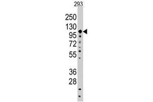 Western blot analysis of SALL4 polyclonal antibody  in 293 cell line lysates (35 ug/lane). (SALL4 anticorps  (C-Term))