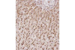 Immunohistochemical analysis of C on paraffin-embedded Human liver tissue. (Glucuronidase beta anticorps  (AA 335-362))