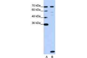 Western Blotting (WB) image for anti-LSM2 Homolog, U6 Small Nuclear RNA Associated (LSM2) antibody (ABIN2462291) (LSM2 anticorps)