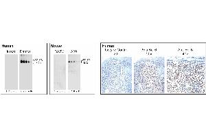 Analysis of Bcl-6 expression by Western blot and Immunohistochemistry. (BCL6 anticorps)