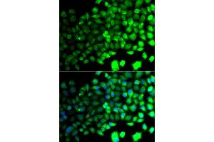 Immunofluorescence analysis of A549 cell using PRKAA2 antibody. (PRKAA2 anticorps)