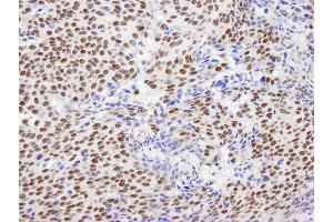 Immunohistochemistry (IHC) image for anti-General Transcription Factor III (GTF2I) (C-Term) antibody (ABIN7448970)