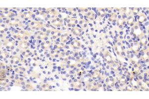 Detection of LDLRAP1 in Mouse Kidney Tissue using Polyclonal Antibody to Low Density Lipoprotein Receptor Adaptor Protein 1 (LDLRAP1)