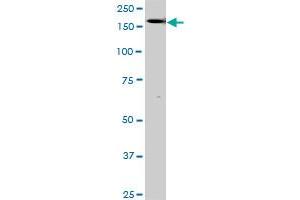 Western Blotting (WB) image for anti-TEK Tyrosine Kinase, Endothelial (TEK) (AA 66-185) antibody (ABIN793004) (TEK anticorps  (AA 66-185))