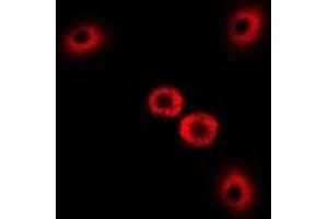 Immunofluorescent analysis of Myosin Ic staining in U2OS cells. (Myosin IC anticorps)