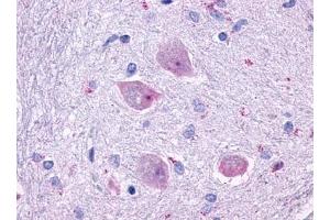 Immunohistochemical staining of Brain (Neurons and glia) using anti- CHRM4 antibody ABIN122327 (CHRM4 anticorps)