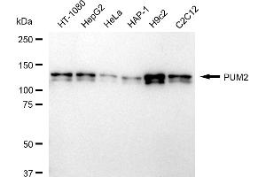 Western blotting analysis using PUM2 antibody (ABIN7800065). (Recombinant PUM2 anticorps)
