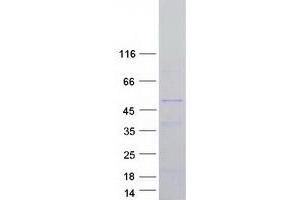 Validation with Western Blot