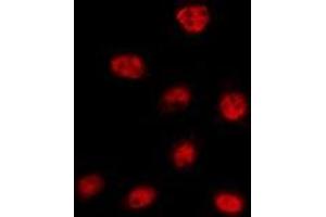 ABIN6275321 staining 293T by IF/ICC. (NCOA7 anticorps  (Internal Region))