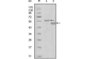 Western blot analysis using EphA6 mouse mAb against truncated MBP-EphA6 recombinant protein (1) and truncated GST-EphA6(aa695-795) recombinant protein (2). (EPH Receptor A6 anticorps)