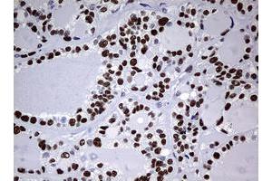 anti-Nibrin (NBN) (AA 183-460) antibody