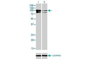 Western blot analysis of OCRL over-expressed 293 cell line, cotransfected with OCRL Validated Chimera RNAi (Lane 2) or non-transfected control (Lane 1).