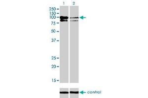 Western blot analysis of OCRL over-expressed 293 cell line, cotransfected with OCRL Validated Chimera RNAi (Lane 2) or non-transfected control (Lane 1). (OCRL anticorps  (AA 146-239))