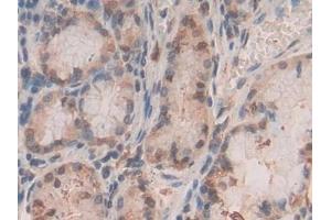 Detection of S100A11 in Human Stomach Tissue using Polyclonal Antibody to S100 Calcium Binding Protein A11 (S100A11)