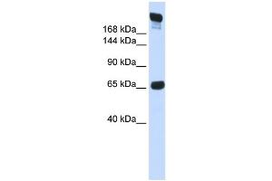 WB Suggested Anti-SI Antibody Titration:  0. (SI anticorps  (N-Term))