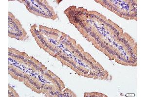 Paraformaldehyde-fixed, paraffin embedded mouse intestine tissue, Antigen retrieval by boiling in sodium citrate buffer(pH6) for 15min, Block endogenous peroxidase by 3% hydrogen peroxide for 30 minutes, Blocking buffer (normal goat serum) at 37°C for 20min, Antibody incubation with ZnT-1 Polyclonal Antibody, Unconjugated  at 1:500 overnight at 4°C, followed by a conjugated secondary and DAB staining