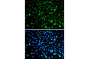 Immunofluorescence analysis of A549 cells using KLF15 antibody. (KLF15 anticorps)