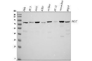 Western blot analysis of MUT using anti-MUT antibody (ABIN4886676). (MUT anticorps  (N-Term))