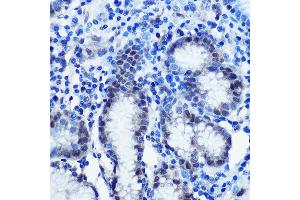 Immunohistochemistry of paraffin-embedded human stomach using BRD4 Rabbit pAb (ABIN7265946) at dilution of 1:100 (40x lens).