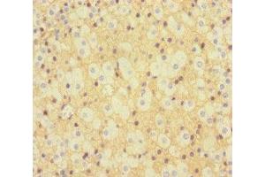 Immunohistochemistry of paraffin-embedded human adrenal gland tissue using ABIN7157290 at dilution of 1:100 (KLHL3 anticorps  (AA 1-301))