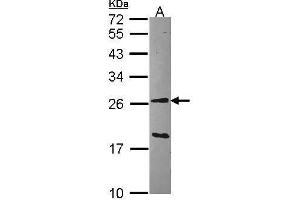 WB Image Sample (30 ug of whole cell lysate) A: Hep G2 , 12% SDS PAGE GSTA1 antibody antibody diluted at 1:1000