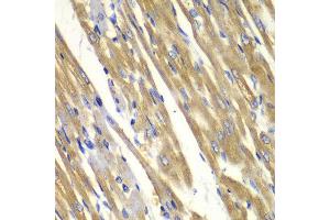 Immunohistochemistry of paraffin-embedded rat heart using TYR antibody at dilution of 1:100 (400x lens). (TYR anticorps)