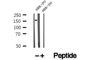 Western blot analysis of extracts of HEK-293 cells, using ZFYVE16 antibody. (ZFYVE16 anticorps  (C-Term))