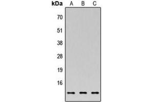 Western blot analysis of C35 expression in MCF7 (A), NS-1 (B), PC12 (C) whole cell lysates. (C17orf37 anticorps  (C-Term))